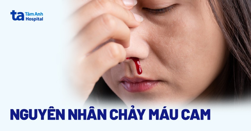 Chảy máu mũi (máu cam): Nguyên nhân, triệu chứng và chẩn đoán