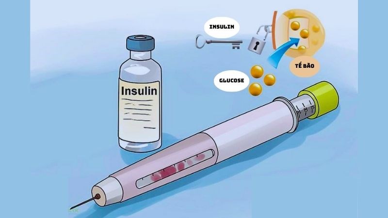 Đái tháo đường là tình trạng đường huyết tăng do đề kháng insulin hay thiếu insulin